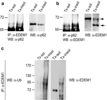 Fig. 8   eDeM1 exists in complex with p62/SQSTM1 and is ubiqui- ubiqui-tinated.  a,  b Combined immunoprecipitation–Western blot analysis  of Triton X-100 soluble sol) and Triton X-100 insoluble  (Tx-insol) fractions shows interaction between p62/SQSTM1 an