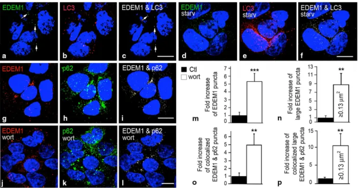Fig. 1  eDeM1 colocalizes with autophagosomes and the selective  autophagy cargo receptor p62/SQSTM1