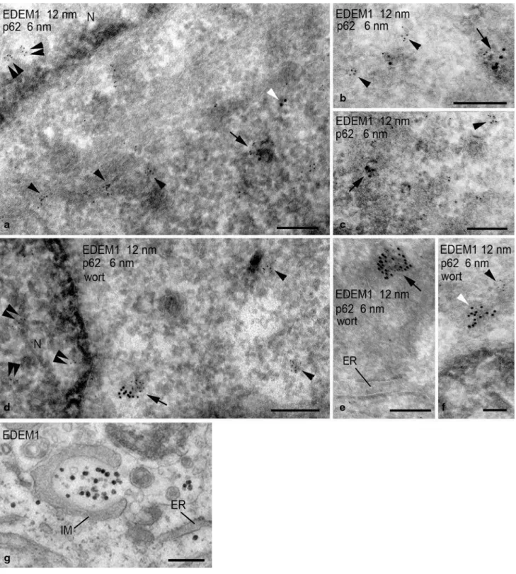 Fig.  2  eDeM1 and p62/SQSTM1 colocalize in the cytoplasm. 