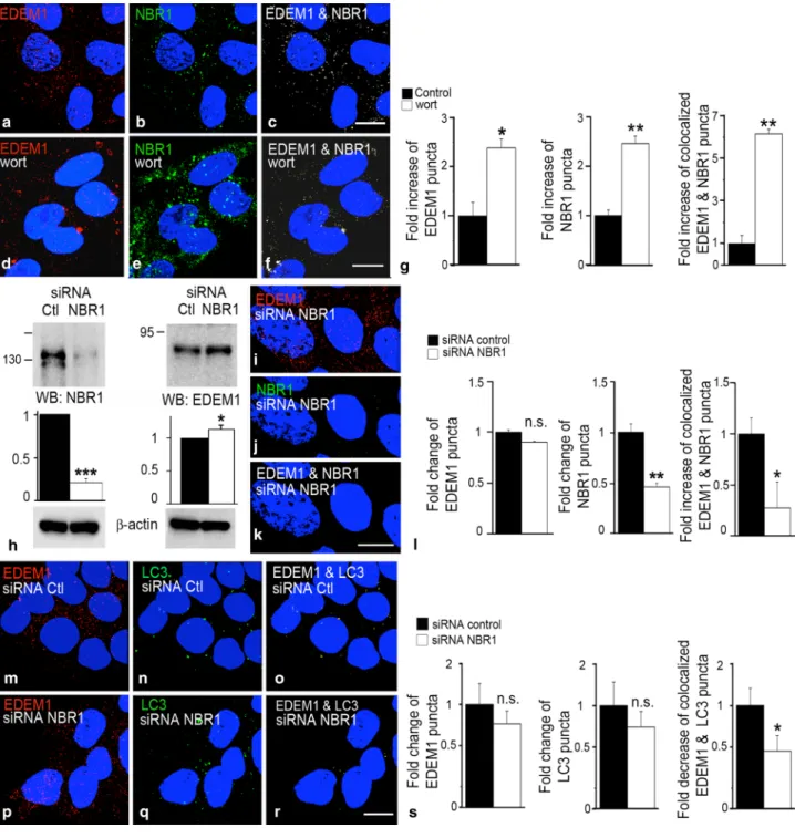 Fig. 3  eDeM1 colocalizes with selective autophagy cargo recep- recep-tor nBr1, and knockdown of nBr1 impedes the colocalization of  eDeM1 and lC3