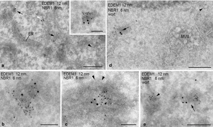 Fig. 4   eDeM1 and nBr1 colocalize in the cytoplasm and become  engulfed by isolation membranes