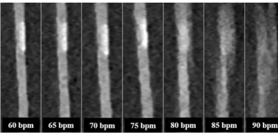 Fig. 3 Plot of the distortion vector [mm] at the different simulated heart rates [bpm]