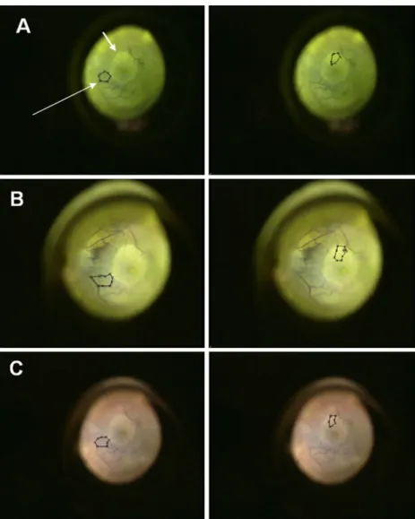 Fig. 3 Screenshot displaying the same region of the fundus with plotted regions of interest (ROIs;