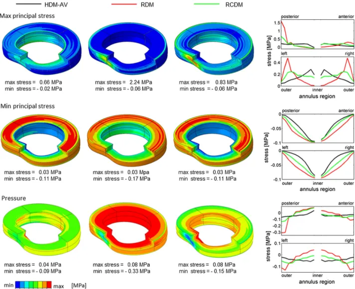 FIGURE 4. Distribution of the von Mises stresses (top) and pressure (bottom) for the model with a uniform lamellae stiffness distribution (HDM-AV, left), a radial stiffness distribution (RDM, center) and a radial-circumferential distribution (RCDM, right) 