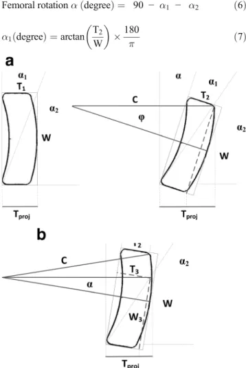 Fig. 5 Representation of DHS® plate projection (Tproj) with and with- with-out rotation