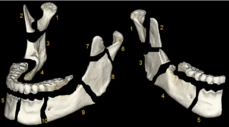 Fig. 3 Equally sized ROIs (10 mm²) were placed in the center of each mandibular region on axial images