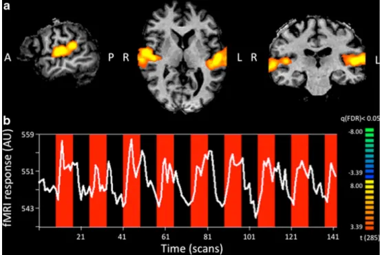 Fig. 1 Regions of interest. a Analysis of the functional auditory localizer run resulted in detection of significant activation (orange) in the left and right auditory cortex