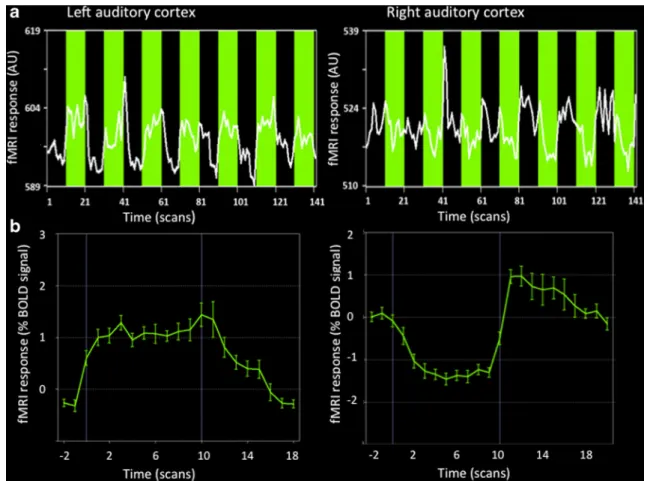 Fig. 2 Results for the tactile stimulation task. a Time courses of left and right auditory cortex activation (Talairach coordinates ±57, − 4, − 1) during right cheek tactile stimulation close to the identified primary cortex