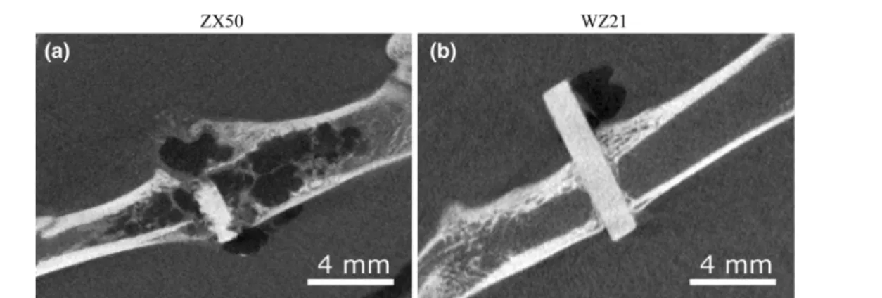 Fig. 1. lCT reconstructions (two-dimensional slices) of Mg-pins implanted into the femur of Sprague–Dawley rats 4 weeks after operation