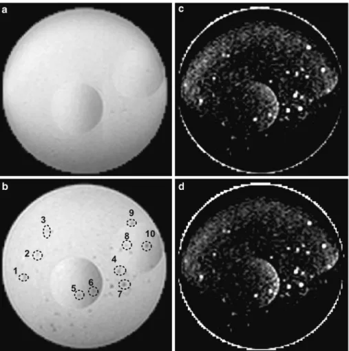 Fig. 1 Cylindrical gel phantom with rat and islets. The circular forms visible in the short a and long, b echo image are smaller gel containers to separate the rat from the human islets