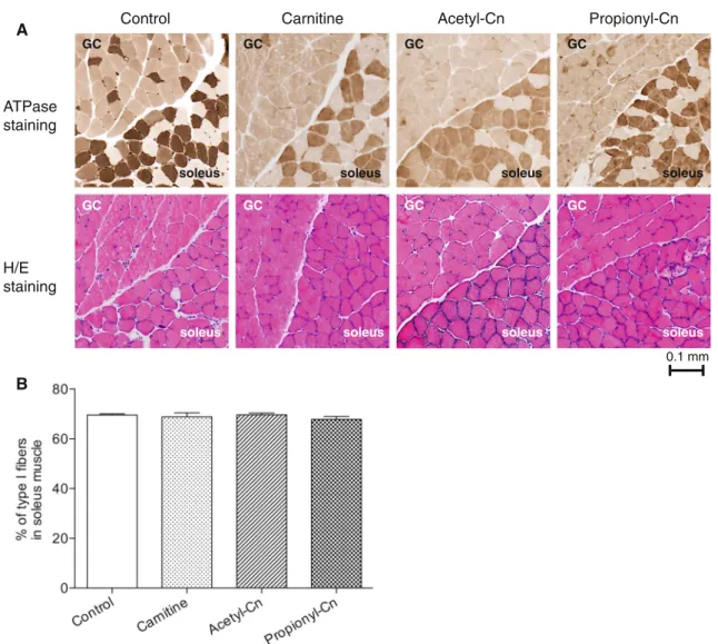 Fig. 3 Histochemical determination of muscle fiber-type composi- composi-tion. a Representative ATPase and hematoxylin/eosin (H/E) staining of soleus and gastrocnemius (GC) biopsies