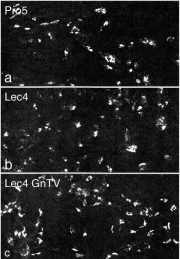 Fig. 2   Confocal laser scanning immunofluorescence for Golgi  α-mannosidase II. CHO Pro − 5 cells (a), CHO Lec4 cells (b), and  CHO Lec4 GnTV-N5 cells (c) exhibit a typical perinuclear Golgi  staining pattern in a single confocal optical section ( × 560)