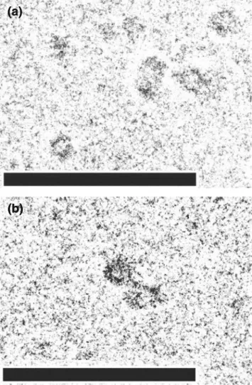 Fig. 3 Cryo-TEM images of the samples from the solution of a B 15-5 and b B 13-9 . The scale bar corresponds to 100 nm