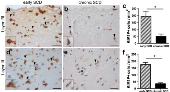 Fig. 2   Marked microglia/macrophage activation in early, but not  chronic subpial MS lesions