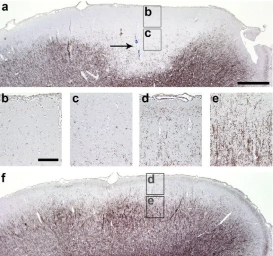 Fig. 6   Focal subpial cortical demyelination in the ipsilateral, but  not contralateral cortex after intracerebral cytokine injection in  rMOg-immunized rats