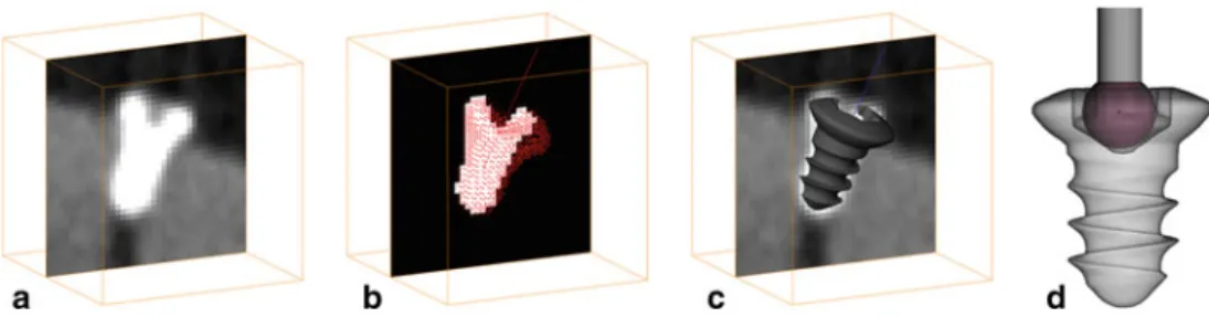 Fig. 3 Fiducial detection workflow in the image: cropped sub-volume (a); extracted features with binary sub-volume (b); and co-registered fiducial model and image (c)