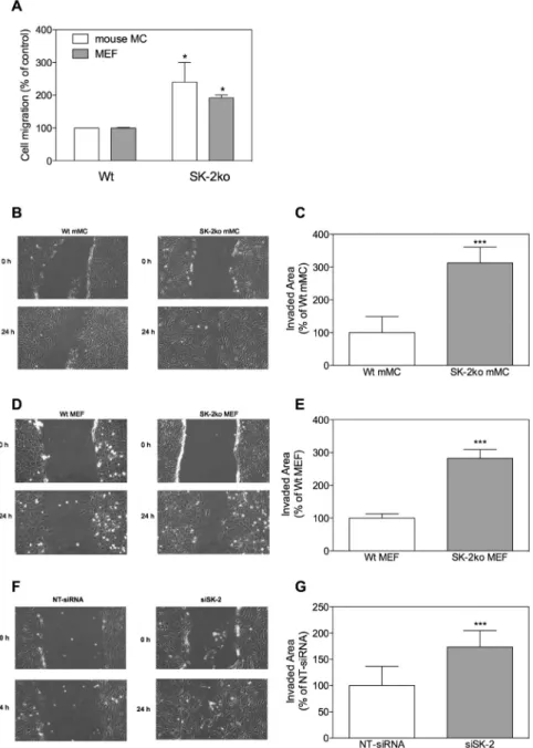 Figure 3: Effect of SK-2 deficiency on migration of mouse mesangial cells and embryonic fibroblasts.