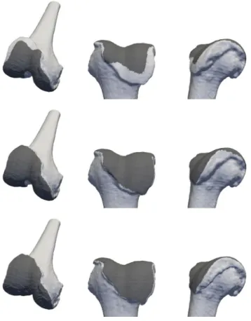 Fig. 6 The figures show the warped reference shape including the col- col-ored patellar surface