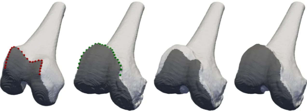 Fig. 1 The first two figures from the left show the reference and target femur surfaces