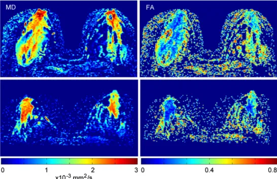 Fig. 2 Colour-encoded mean diffusivity and fractional anisotropy parametrical maps in two healthy volunteers (top and bottom row, respectively) are displayed