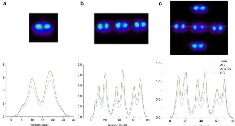 Fig. 6. Representative slices of the simulated MOBY phantom ( upper row ) and their corresponding horizontal profiles ( lower row ) comparing true, uncorrected ( NC ), attenuation corrected ( AC ) and attenuation and scatter-corrected ( AC + SC ) images fo