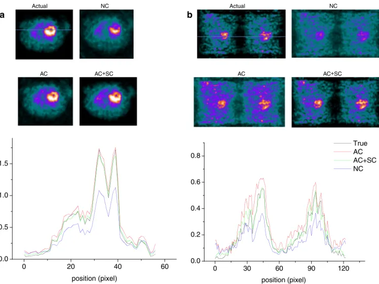 Fig. 8. Representative slices of the simulated ROBY thorax region ( upper row ) and their corresponding horizontal profiles ( lower row ) comparing true, uncorrected ( NC ), attenuation corrected ( AC ) and attenuation and scatter-corrected ( AC + SC ) for