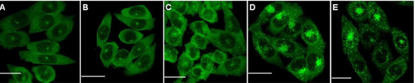 Fig. 1   Confocal microscopy images (maximum intensity projection) of arrestin 3-gFP in fixed CHO-CCr5 cells in the absence of ligand (a) or  after 90 min of stimulation with 5P12-ranTeS (b), 5P14-ranTeS (c), ranTeS (d), or PSC-ranTeS (e)