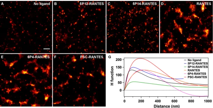 Fig. 2   representative super-resolution images of aTTO655-nano- aTTO655-nano-body-labelled arrestin 3-gFP in fixed CHO-CCr5 in the absence of  ligand (a) and after treatment with different chemokine analogues for  90 min (b–f)