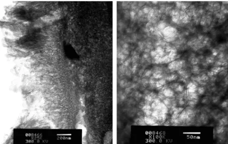 Fig. 1. Bright-ﬁeld TEM images of C–S–H gels. Left: two standard textures of the gel: