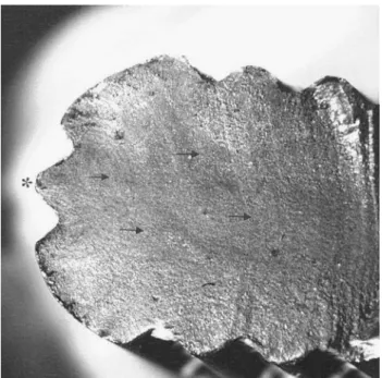 Fig. 2 Cross-section of the fracture site. The most lateral groove (asterisk) is the initiation point for the lines that indicate fatigue stress (arrows) from lateral to medial