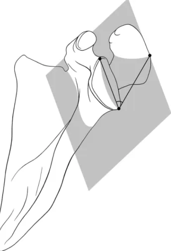 Fig. 4 Relationship between the CSAs measured on CT scans and radiographs