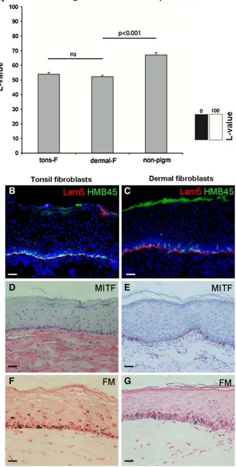 Fig. 3 Melanocyte function and position in pigmented skin analogs constructed with  tonsil-derived mesenchymal cells and with dermal fibroblasts 3 weeks after transplantation.