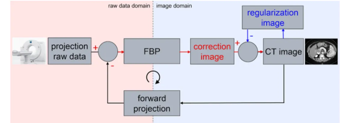 Fig. 1  Schematic depiction of  the principle of Sinogram  Affir-med Iterative Reconstruction, the  iterative reconstruction approach  implemented on the Somatom  Definition Edge