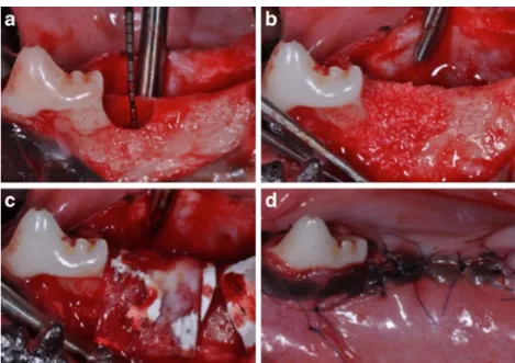 Fig. 1 Views after a surgical creation of an intrabony periodontal defect at the distal aspect of the PM2, b application of pulverized DBBM filler, c coverage of the filled defect with a collagen barrier membrane, and d flap repositioning and suturing for 