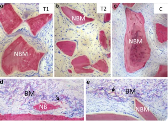 Fig. 5 Representative photomicrographs illustrating embedding of DBBM particles in soft tissue without the formation of new bone for a group T1 (paste-like DBBM), b group T2 (pulverized DBBM), and c group C (control DBBM)