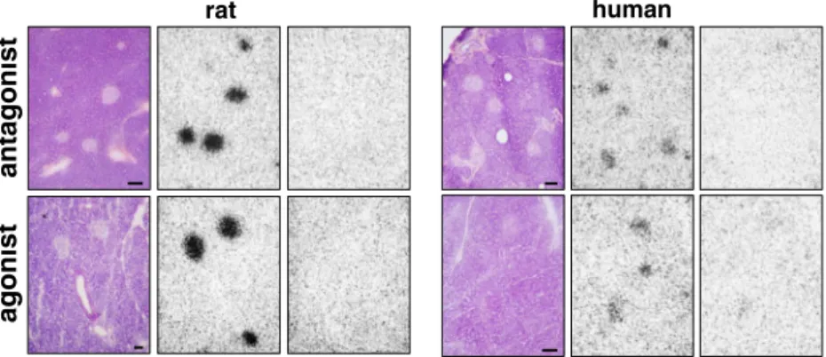 Fig. 2 GLP-1 receptor autoradiography in rat (left panels) and human (right panels) pancreatic islets using the antagonist tracer 125  I-BH-exendin(9 – 39) ANAWA peak 4 (upper row) or the agonist tracer 125 
