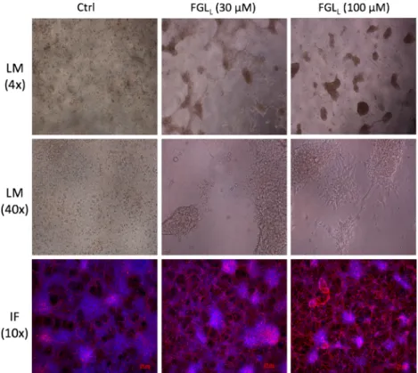 Fig. 9. The effect of FGL L on human ES cells neural differentiation. Neural differentiation after 18 days, cells exhibit increasingly neuritic extensions in the presence of FGL L from 30 to 100 μ M under 4 and 40 times magni ﬁ cation of light microscope (