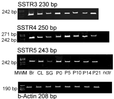 Fig. 2 Expression of SSTR3, -4 and -5 in the cell lysat (Jayanthi et al.