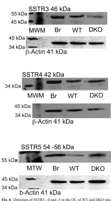 Fig. 6 Detection of SSTR3, -4 and -5 in the OC of WT and DKO mice cochlea by western blotting