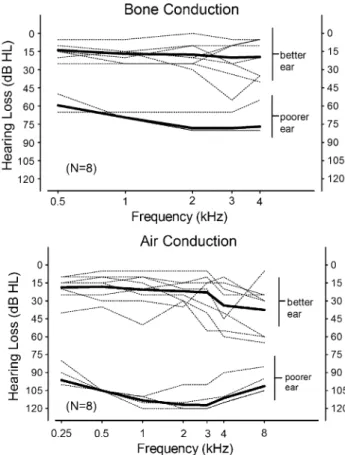 Fig. 1 Bone conduction and air conduction thresholds of the eight study subjects. Dotted lines indicate individual measurements and solid lines indicate average values