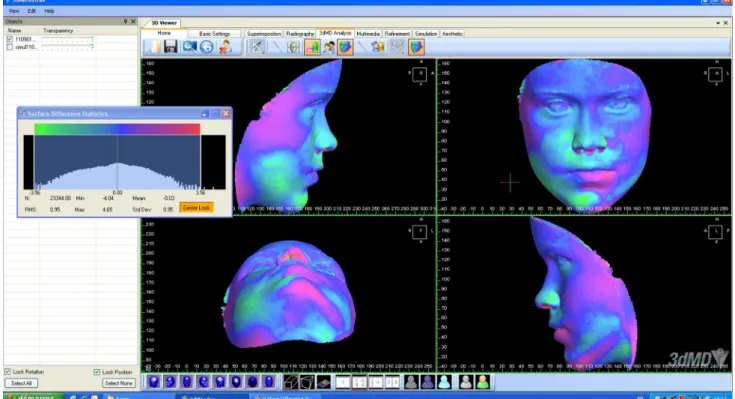 Fig. 6 Distribution of the differences shown by the software. The values correspond to the values for the lower part of patient no