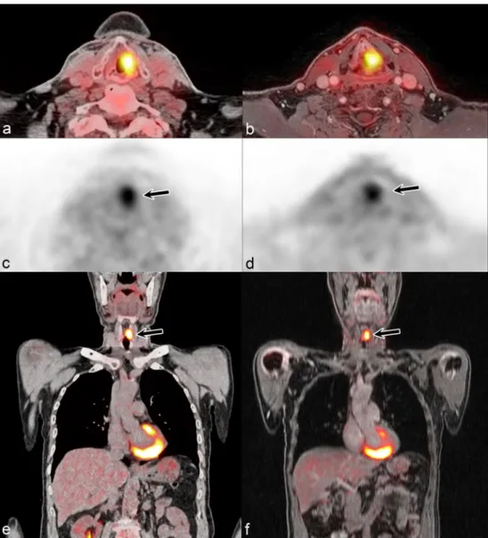 Fig. 5). The final diagnosis in these eight lesions with a discor- discor-dant rating was based on histology alone or histology and follow-up in six lesions