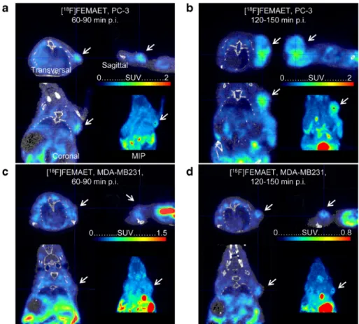 Fig. 5. PET/CT images of xenograft-bearing mice after [ 18 F]FEMAET administration. a, b ATB 0,+ -positive PC-3 xenografts; c, d ATB 0,+ -negative MDA-MB-231 xenografts