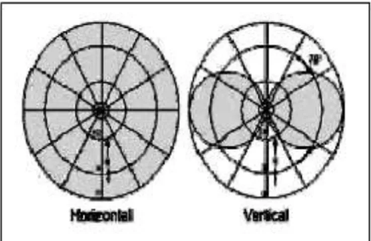Figure 11. Directivité Omnidirectionnelle 