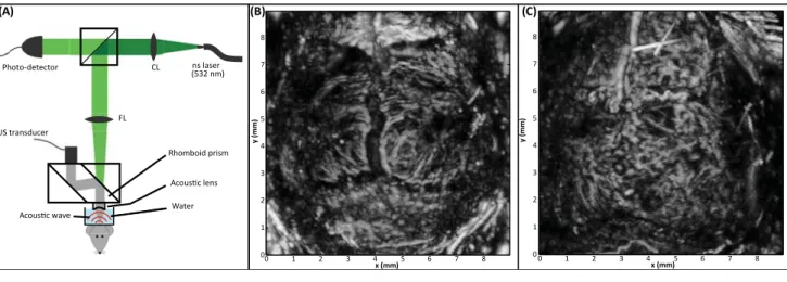 Figure 3. Optoacoustic Microscopy Setup and Imaging of the Brain. (A) Optoacoustic (OA) microscopy setup (acoustical resolution)