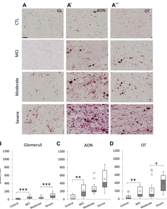 Fig. 2. Progressive tau pathology in the olfactory nerve with the increasing severity of dementia