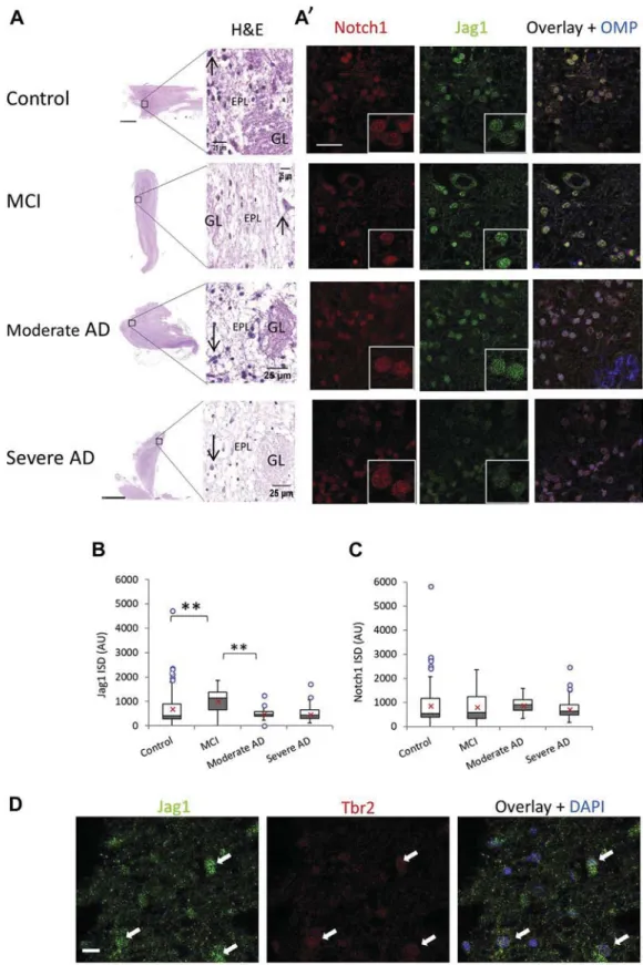 Fig. 5. Changes in signaling proteins in mitral cells with the progression of dementia