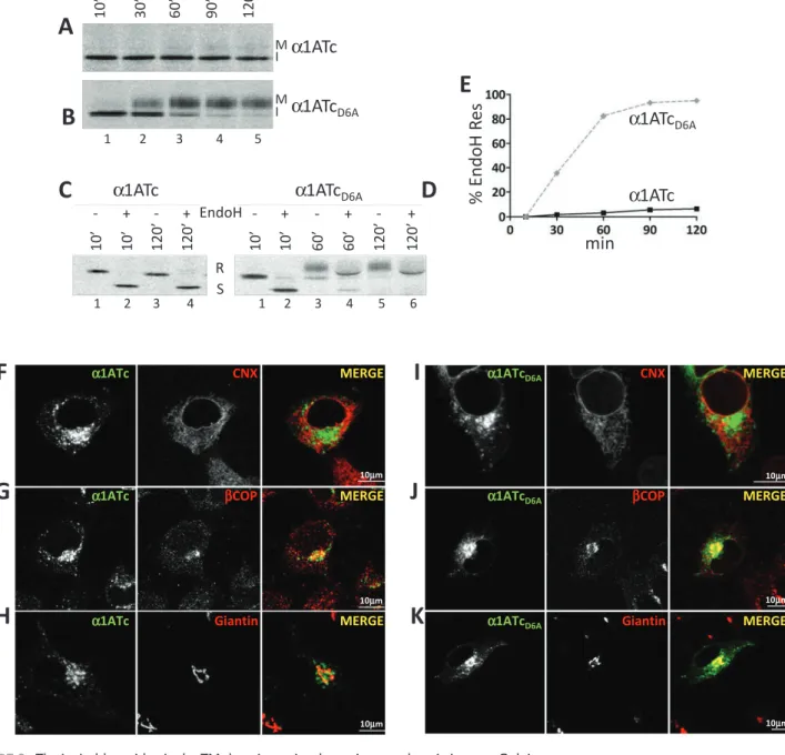 FIGURE 3:  The ionizable residue in the TM domain retains the native ectodomain in a pre-Golgi compartment
