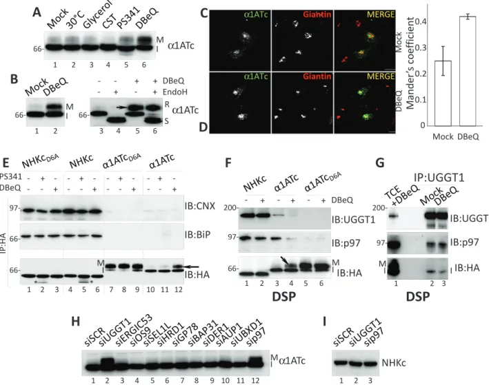 FIGURE 5:  p97 and UGGT1 participate to the DBeQ-sensitive protein quality checkpoint