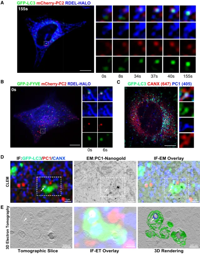 Figure 2. Autophagy sequesters PC molecules in the ER.